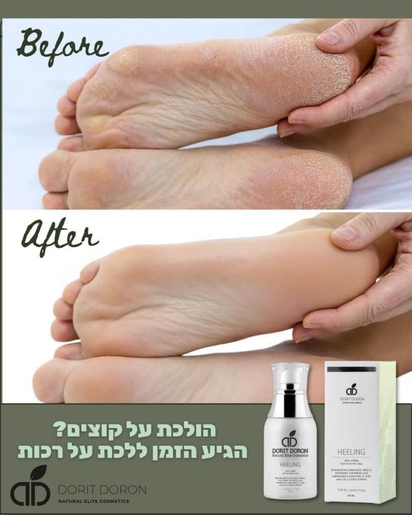 קרם רגליים טיפולי